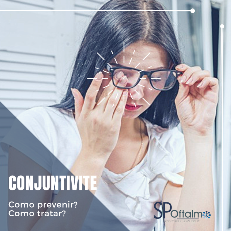 Conjuntivite: como prevenir? Como tratar?