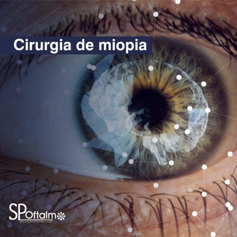 Cirurgia de miopia