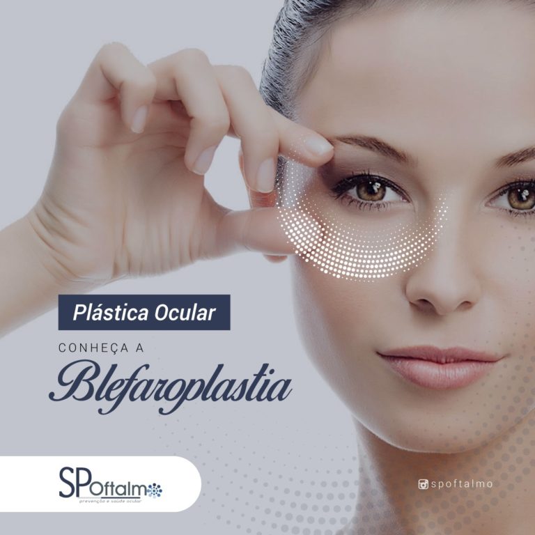 Plástica Ocular: Conheça a Blefaroplastia