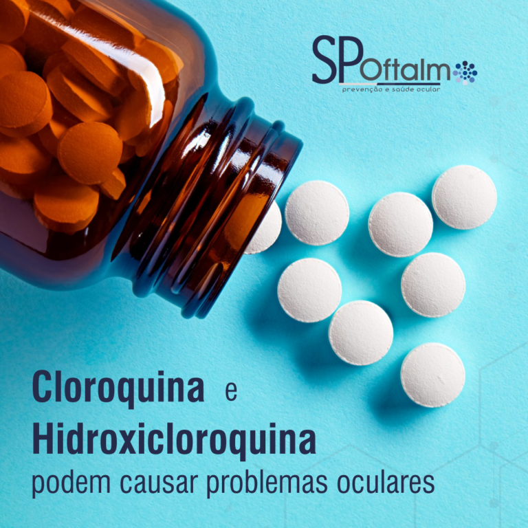 Cloroquina e Hidroxicloroquina podem causar problemas oculares?