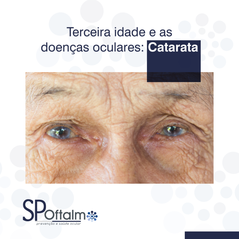 Terceira Idade e as doenças oculares: Catarata