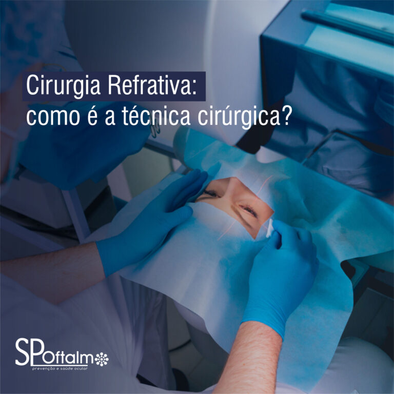 Cirurgia Refrativa: como é a técnica cirúrgica?